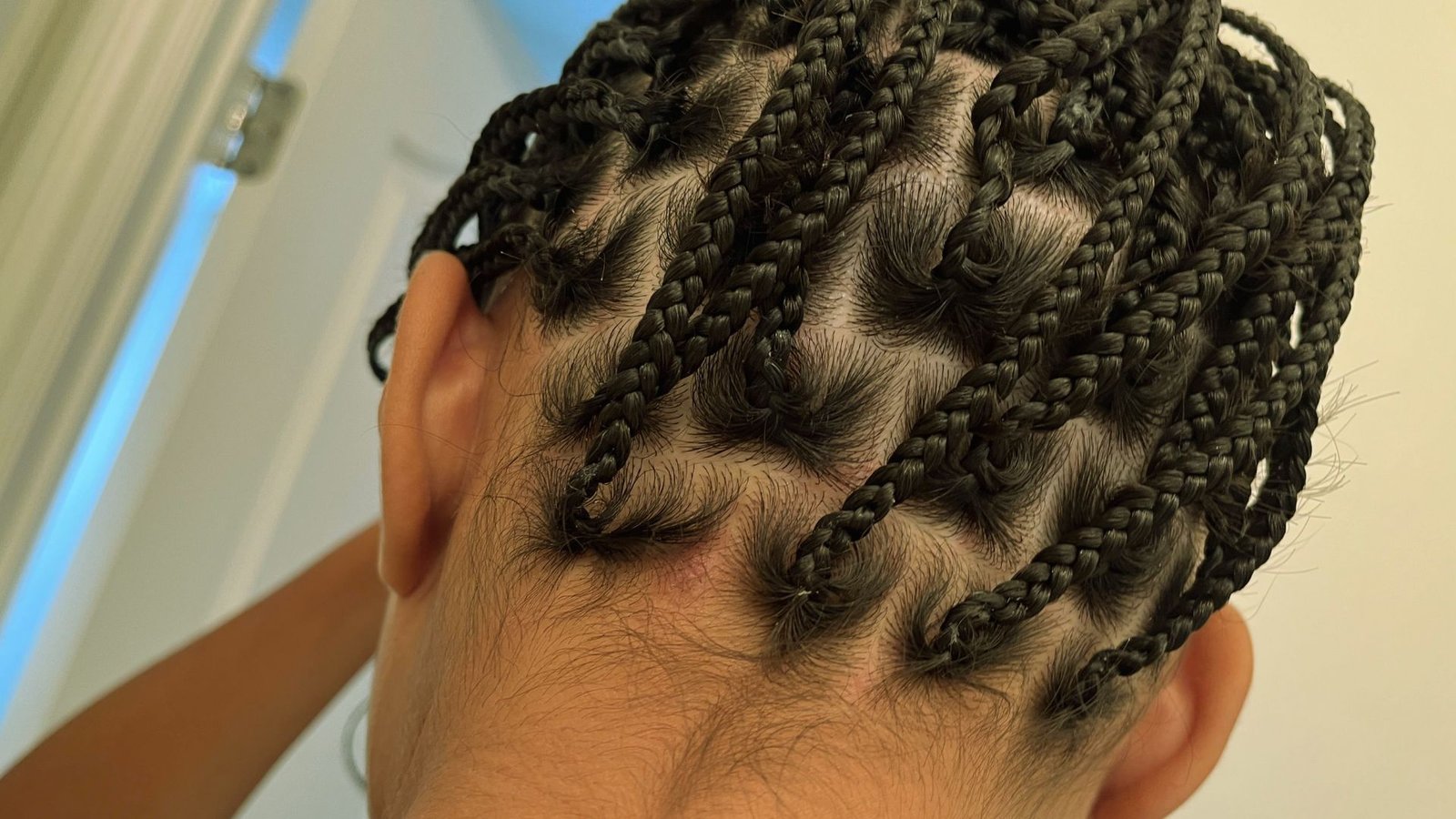 Take Extra Care During the First 48 Hours