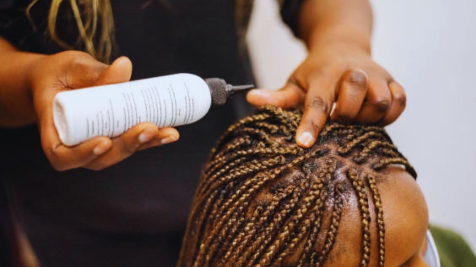 Allergic Reactions to Synthetic Hair